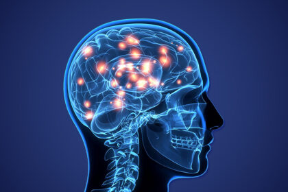 EEG