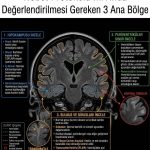 Nöbet Protokolu MR'ında Değerlendirilmesi Gereken 3 Ana Bölge